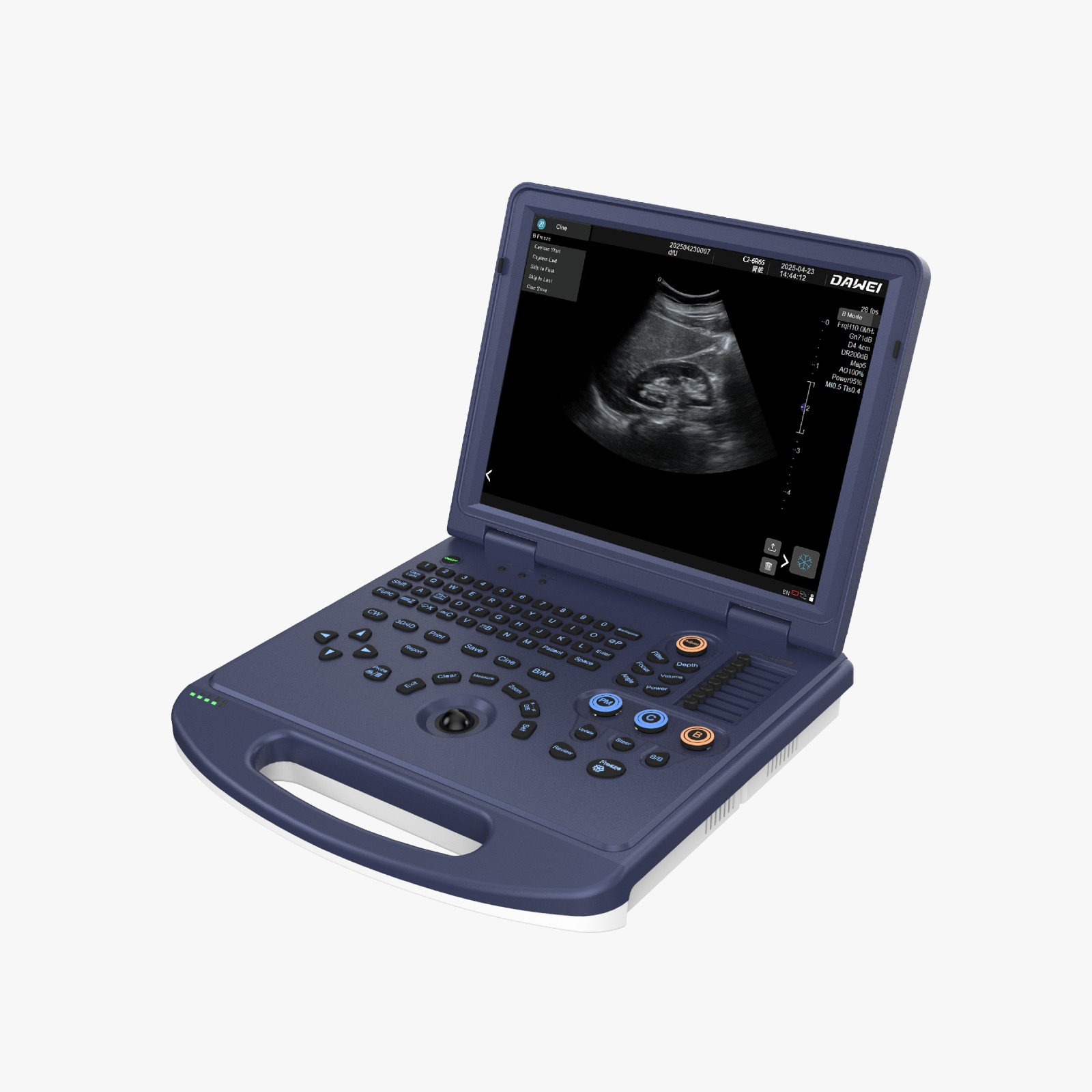 DW L3i Colour Doppler Portable Ultrasound