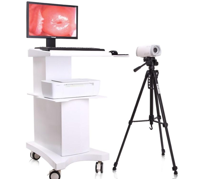  Colposcope LTY-9802 Video Trolley 
