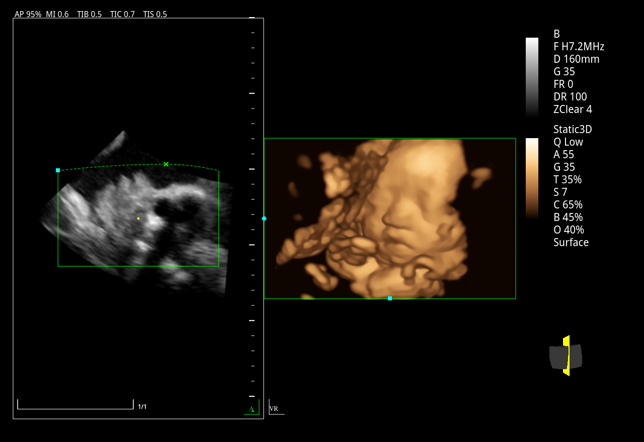 Zoncare M30 Portable Ultrasound